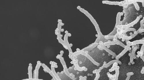 Imágenes muestran cómo el coronavirus ataca a las células 